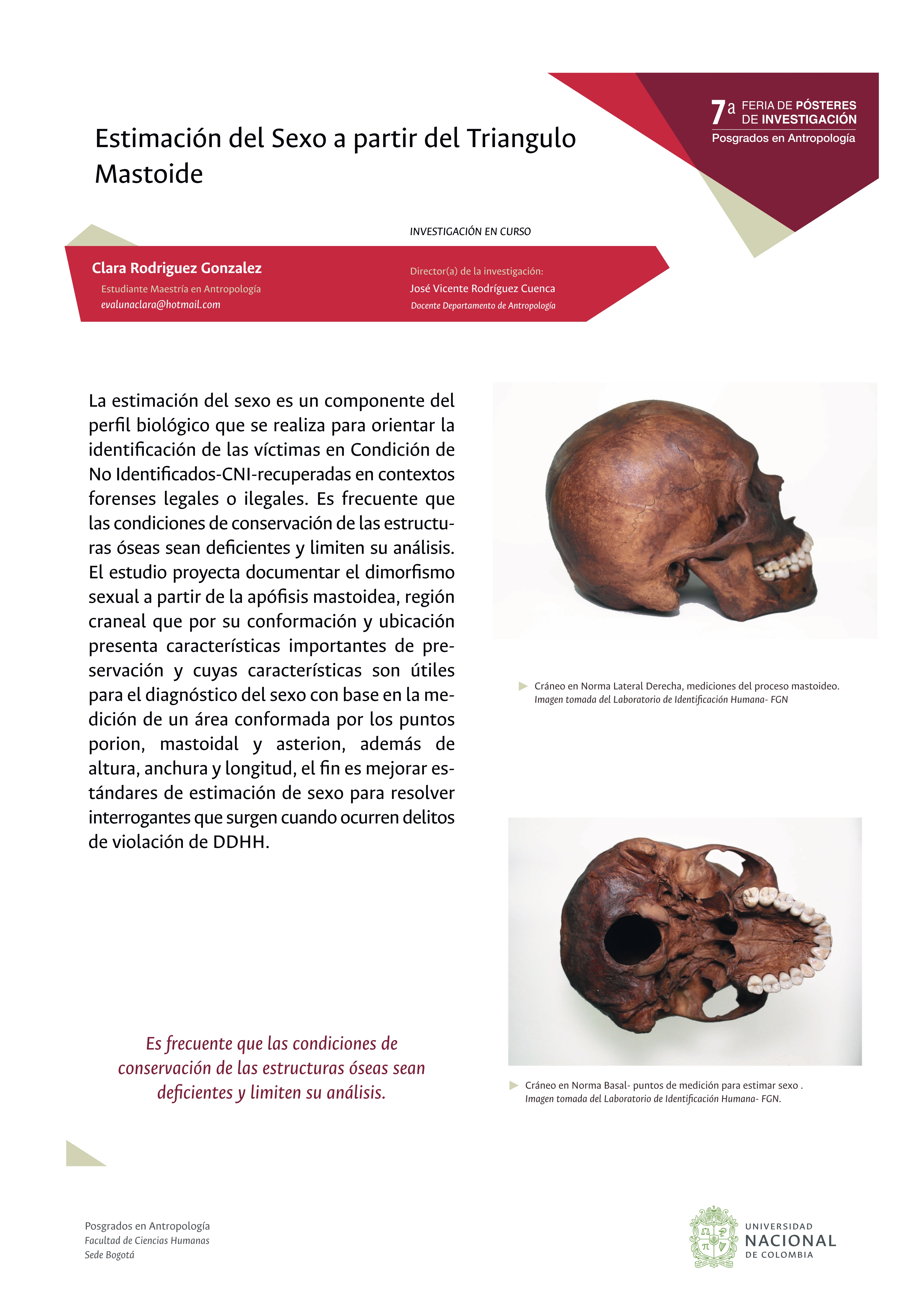 Estimación del sexo a partir del triángulo mastoide